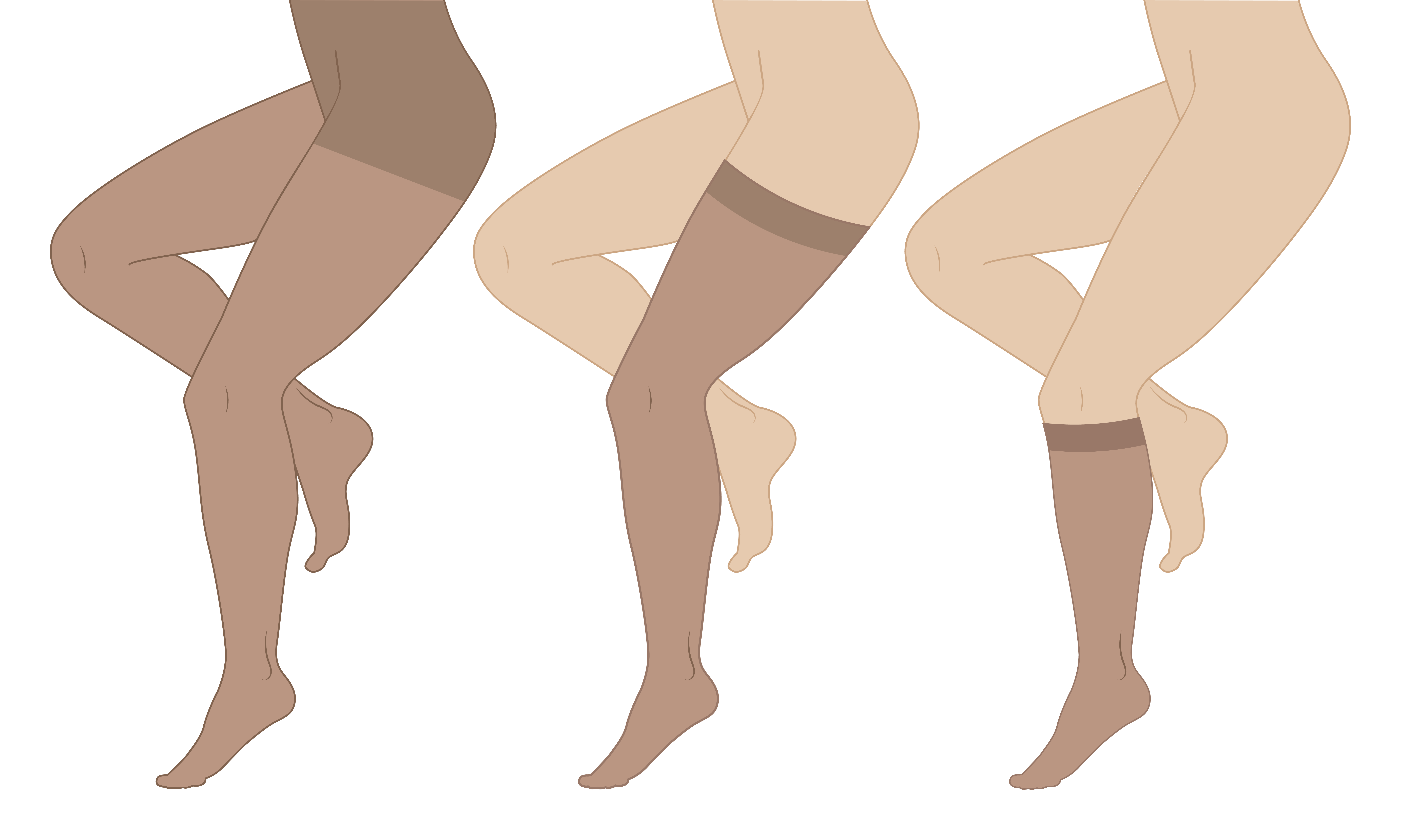 Do Compression Stockings Work?: Center for Varicose Veins: Board Certified  Vascular and Interventional Radiologists